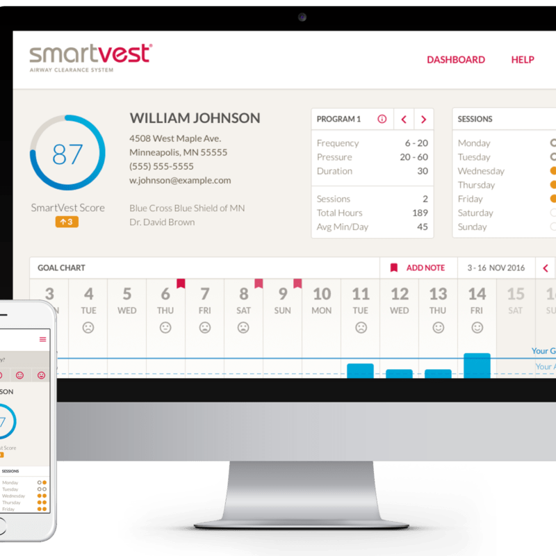 SmartVest SQL with SmartVest Connect wireless technology makes it easy to track therapy performance and provides collaboration between patient and healthcare professionals in treatment decisions.
