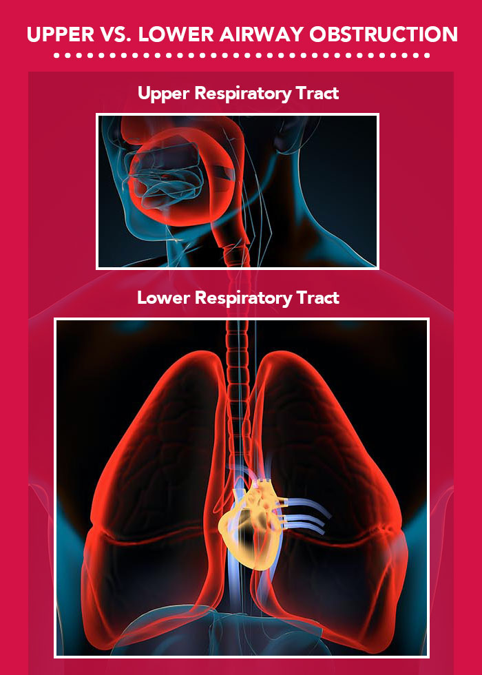 Internal image of upper and lower respiratory tract comparison.